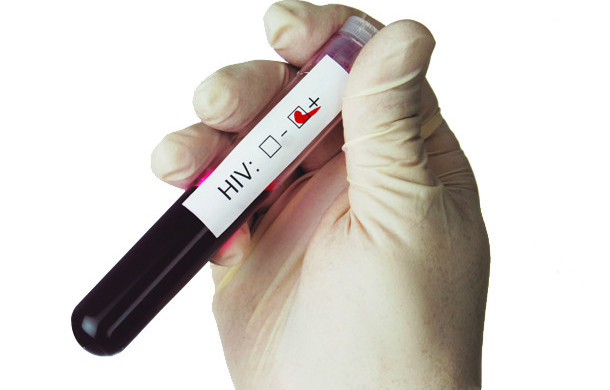 Эксперымент: як карэспандэнт Еўрарадыё здавала аналізы на ВІЧ