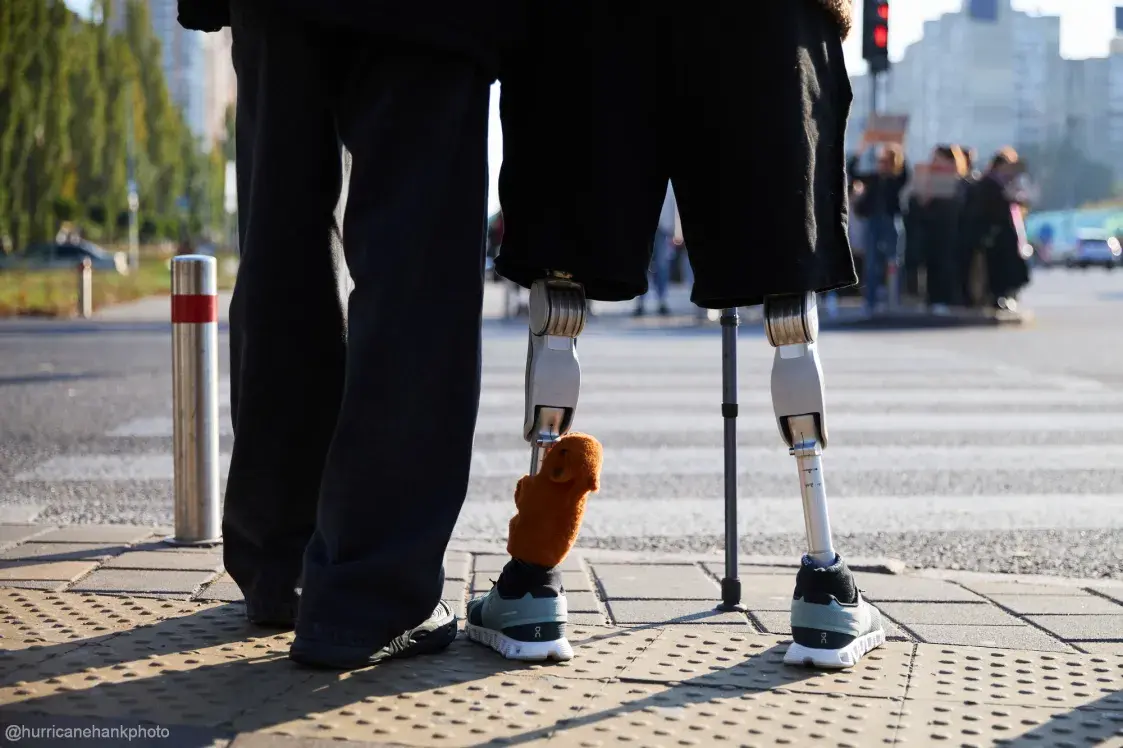 "Это не его ранение, а наше”. Как любовь спасла ветерана “Азова”