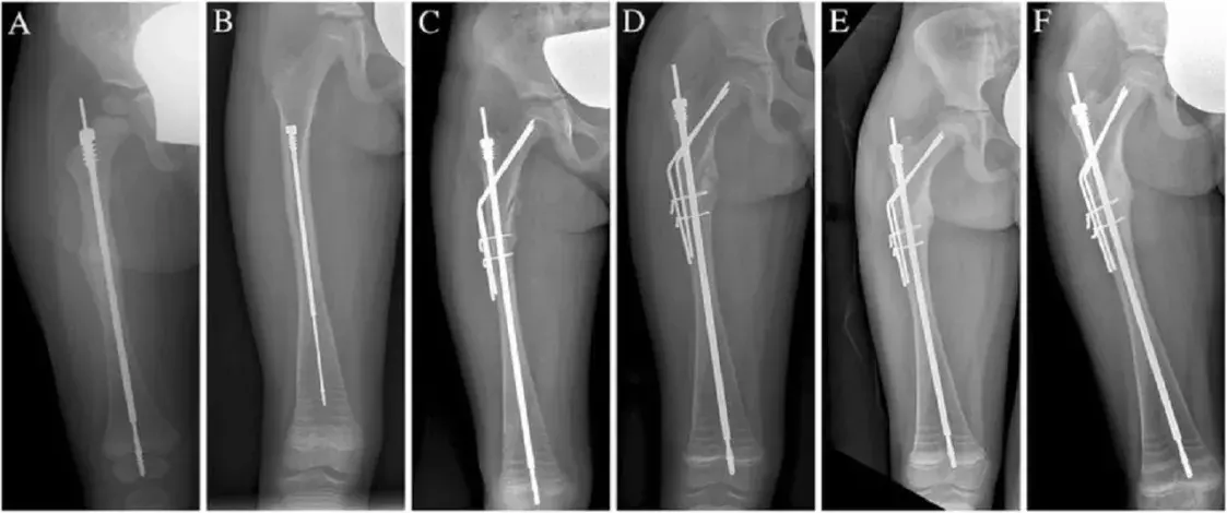 Детей не хотят оперировать? Что происходит в РНПЦ травматологии и ортопедии
