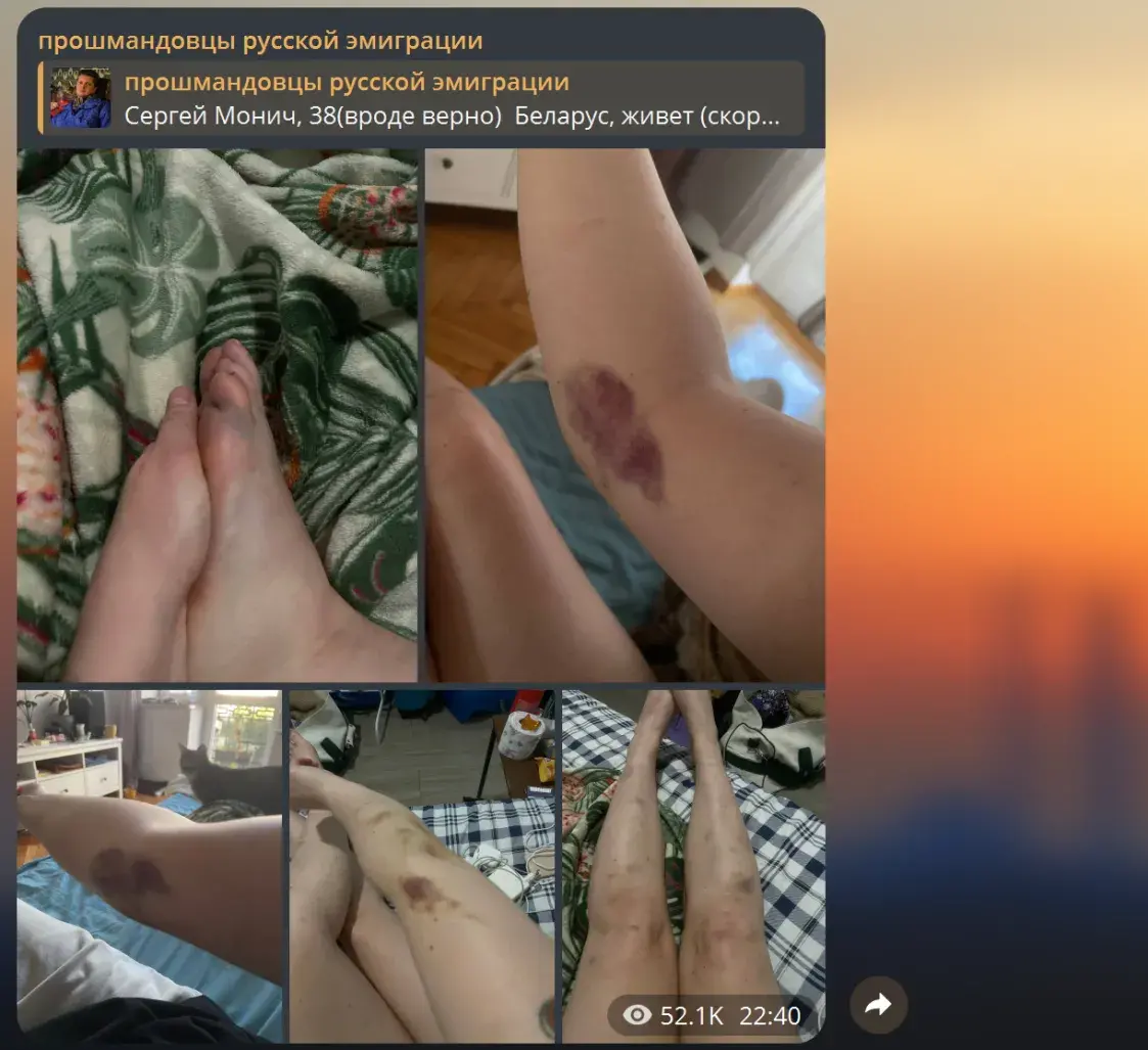 Экс-палітвязня абвінавацілі ў хатнім гвалце. Яго жонка лічыць гэта паклёпам