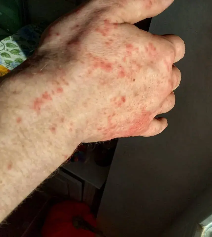 Беларус апынуўся ў камеры з клапамі пасля сямейнай паездкі за мяжу