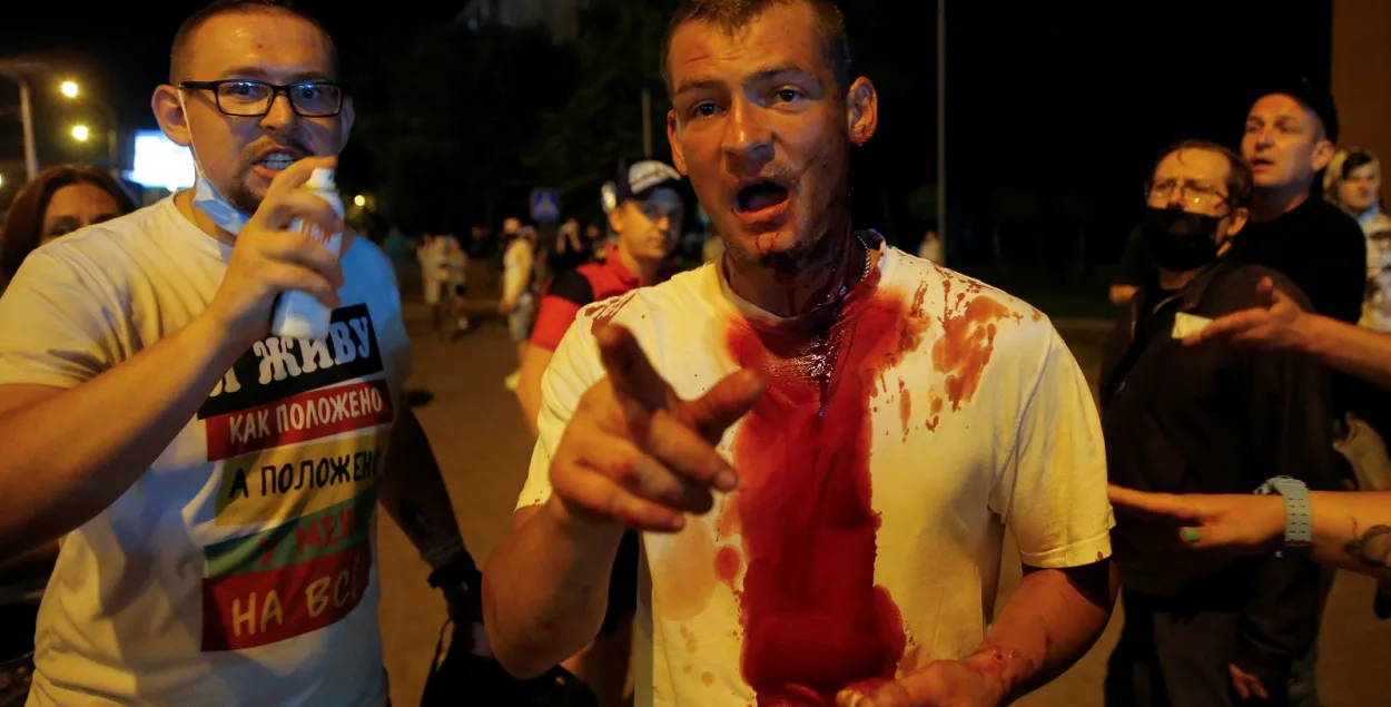 Пострадавший во время разгона протестов в Минске / Reuters