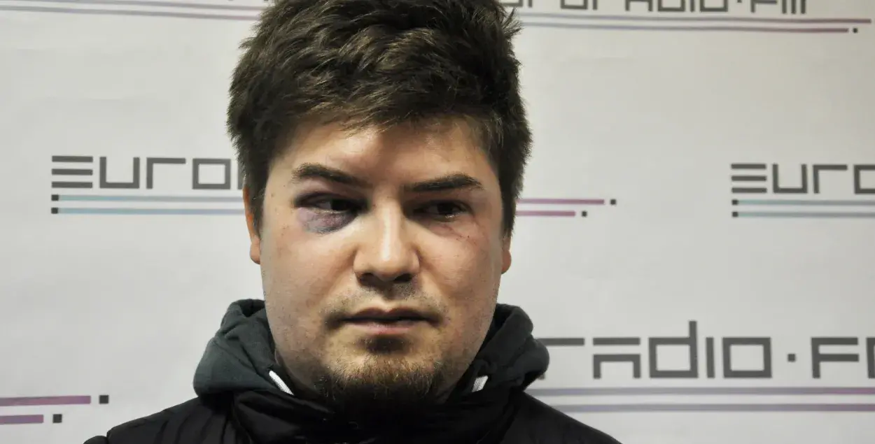 Олег Ларичев через день после избиения в подъезде. Фото: Еврорадио.