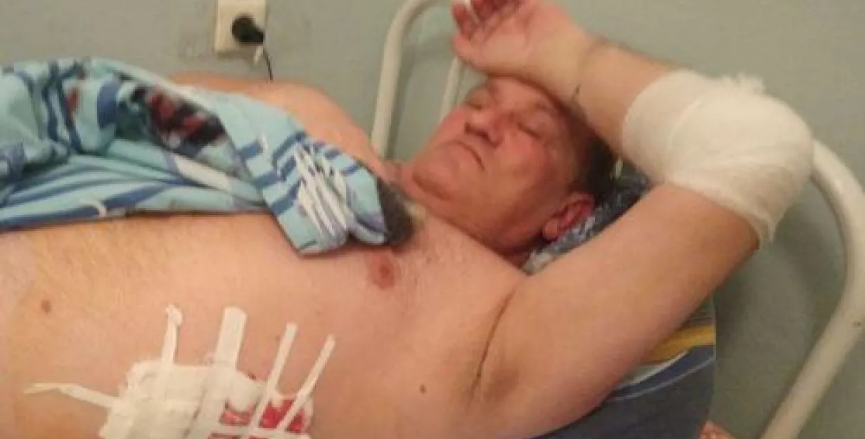 Корреспондент "Кавказского узла" ранен при вооруженном нападении