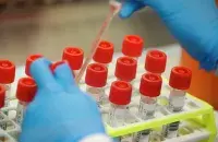 В Минске циркулирует сразу несколько штаммов
