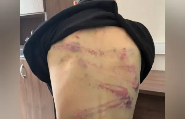 Артемий Останин показал, как его пытали белорусские силовики
