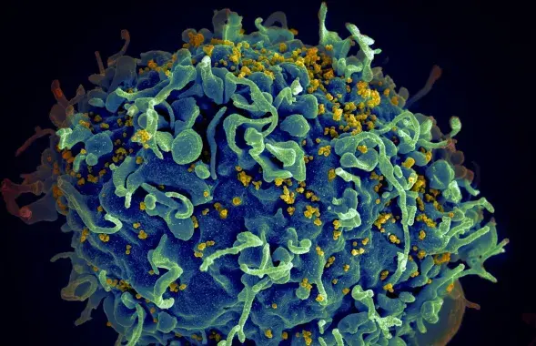 ВІЧ (жоўтае) паражае клетку чалавека
